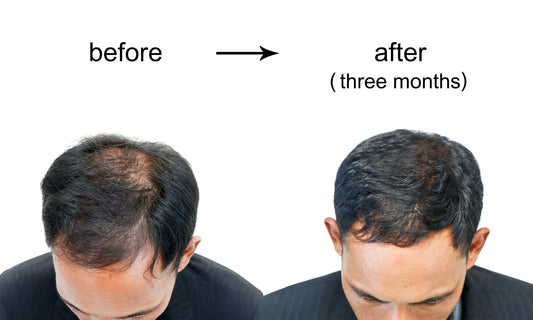 Procapil: Unveiling the Potential of a Novel Ingredient for Hair Growth and Strengthening