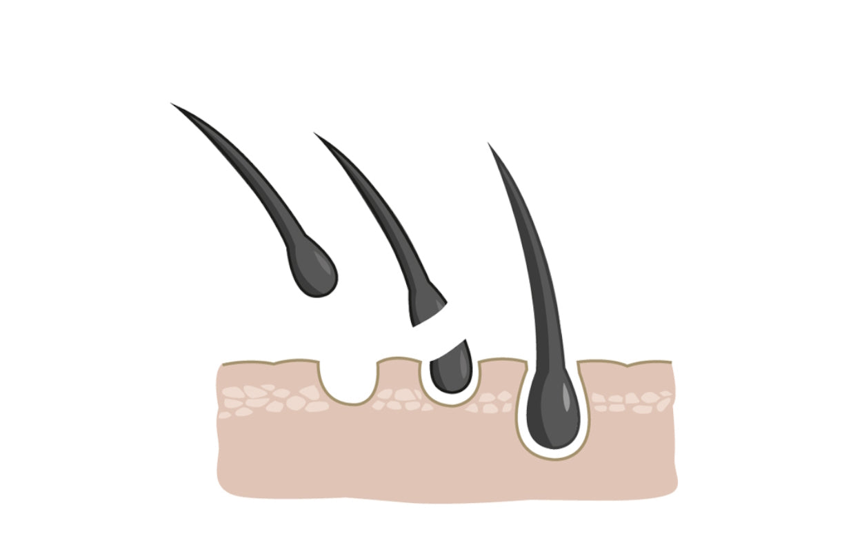 Addressing Underlying Medical Conditions Causing Hair Loss myUpchar