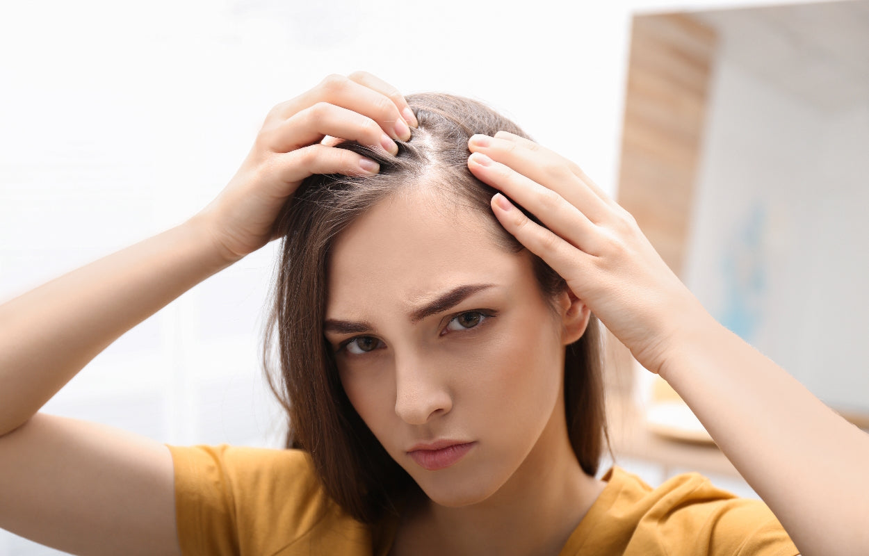 Female Pattern Hair Loss Causes and Solutions myUpchar Ayurveda