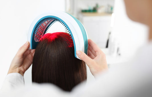 Laser Therapy for Hair Loss: How Does It Work?