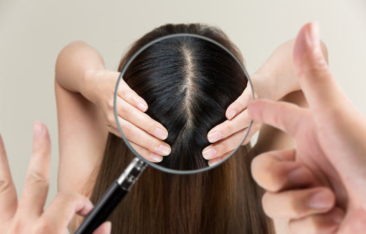 Role of Scalp Health in Preventing Hair Loss